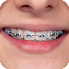 Braces Photo Editor - Booth
